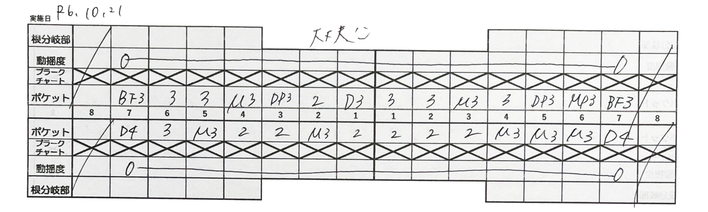 歯周病対策でCELA水でうがいをして歯肉炎が改善